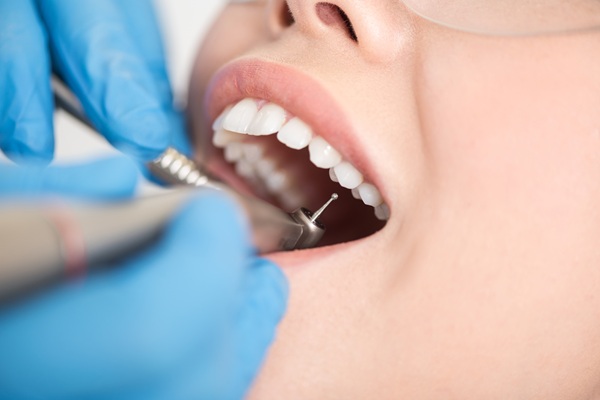 What To Know About Dental Filling Material Options